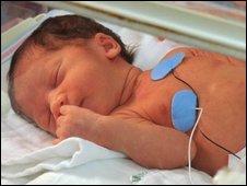 Hope Of Lung Growth For ‘Premature Baby’ 